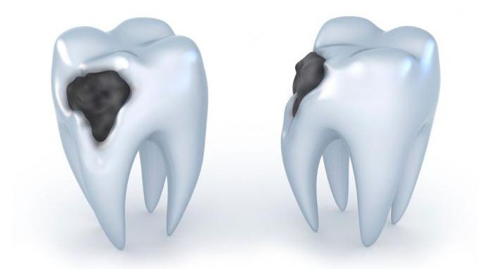болезни зубной полости