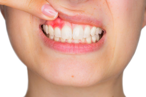 осложнения перфорации зуба