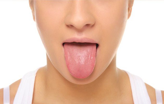 рак языка признаки и симптомы 