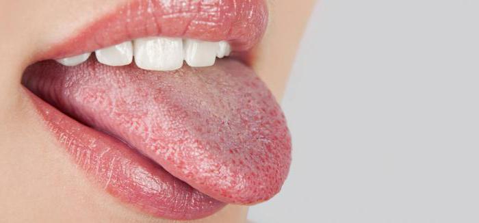 Опухший язык с отпечатками зубов, лечение