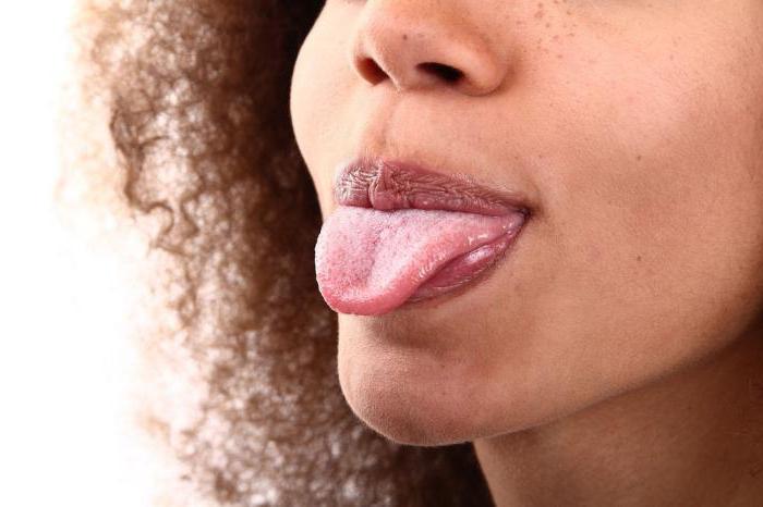 Опухший язык с отпечатками зубов