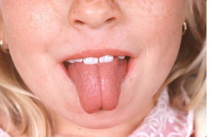 Опухший язык после прокола, фото
