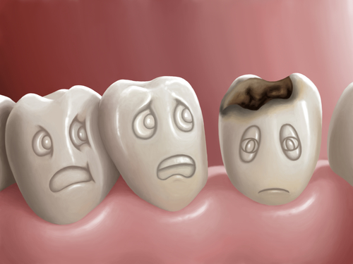 болезнь зубов