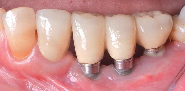 3d снимки зубов