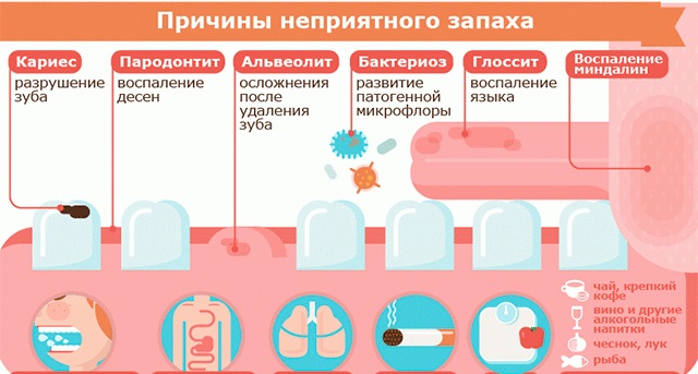 Запах изо рта - причины и лечение