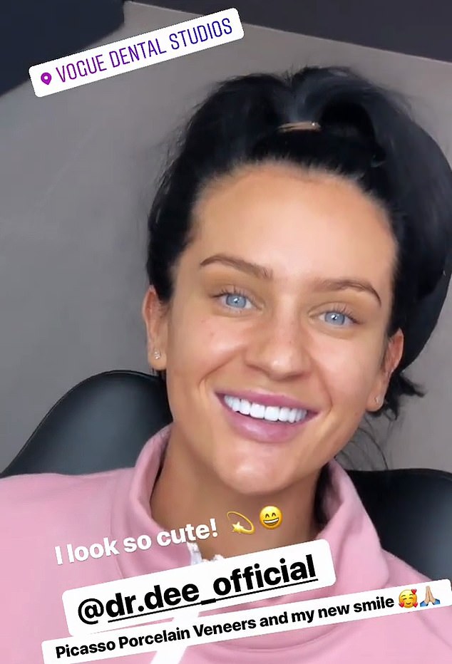 Transformed: In a series of Instagram Story posts, Ines showed off her dazzlingly bright smile and noticeably longer teeth