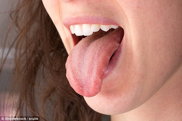 A scalloped tongue (one with ridges on the outside edge) indicates fluid retention (stock image)
