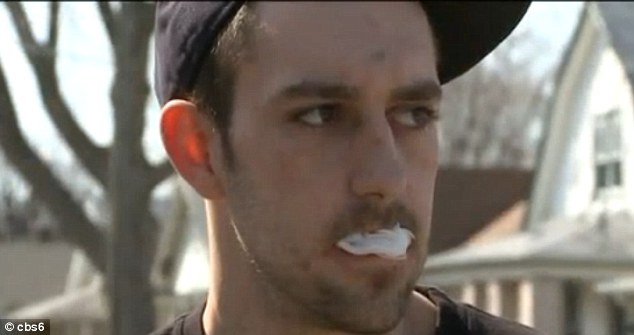 Toothless: Christopher Crist, 21, had all his teeth removed when he went for three extractions at a dentist