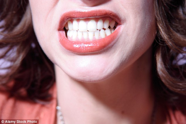 Cindy knew she had a wobbly tooth but she baulked when a dentist told her she needed to have it pulled out