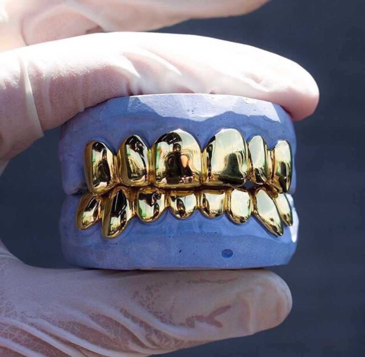 Золотые зубы. Diamond Grillz. Золотые металлические коронки.