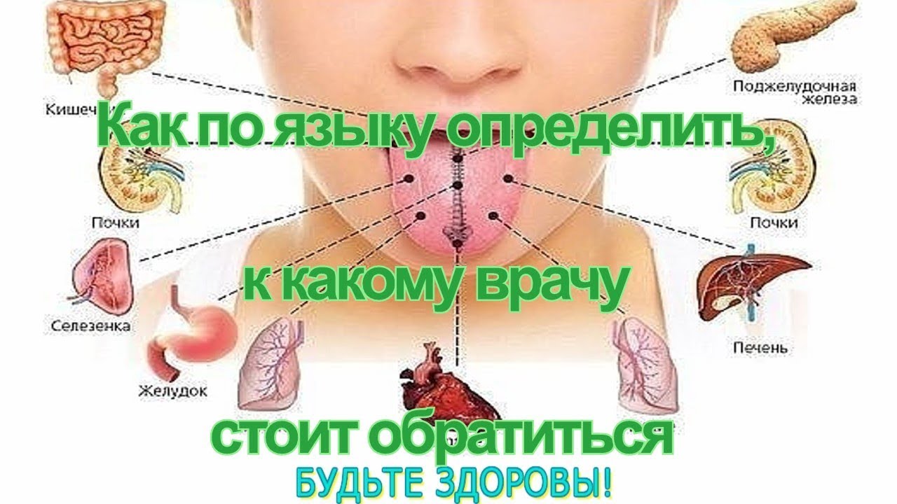 Диагноз по языку в картинках определение болезни