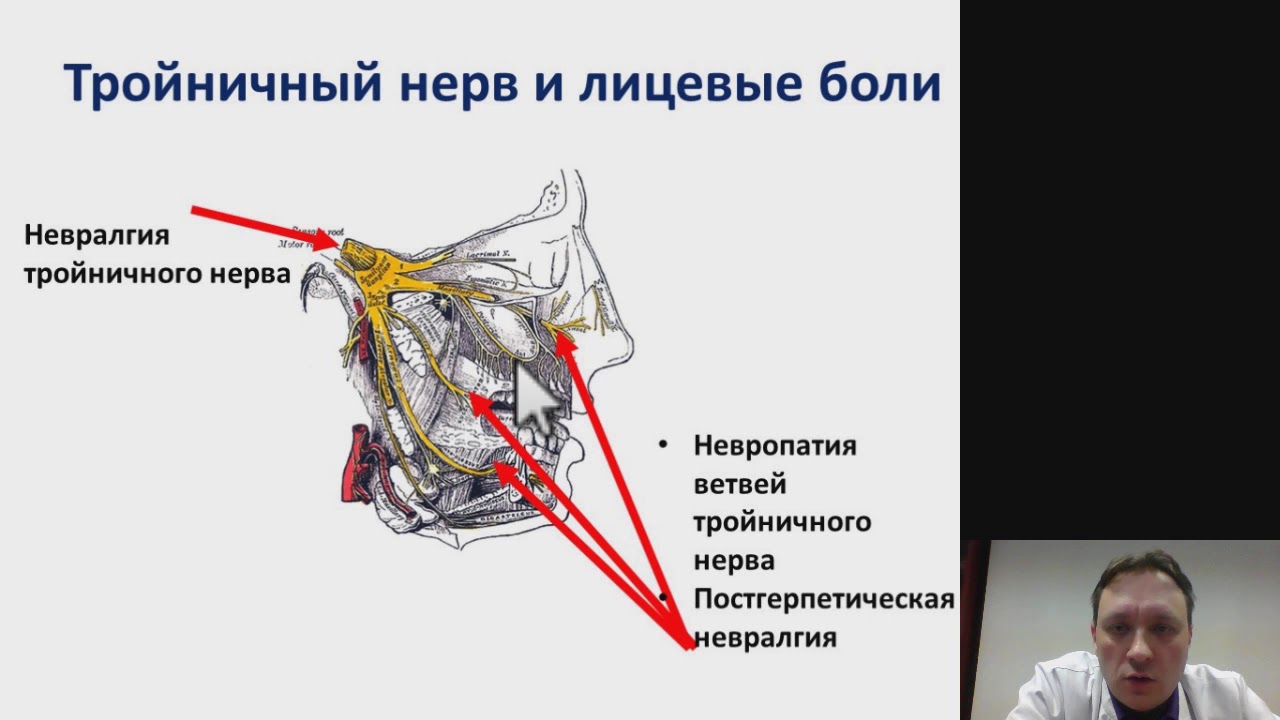 Тройничный нерв на лице симптомы и лечение фото где находится