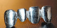 metal frame for dental ceramics