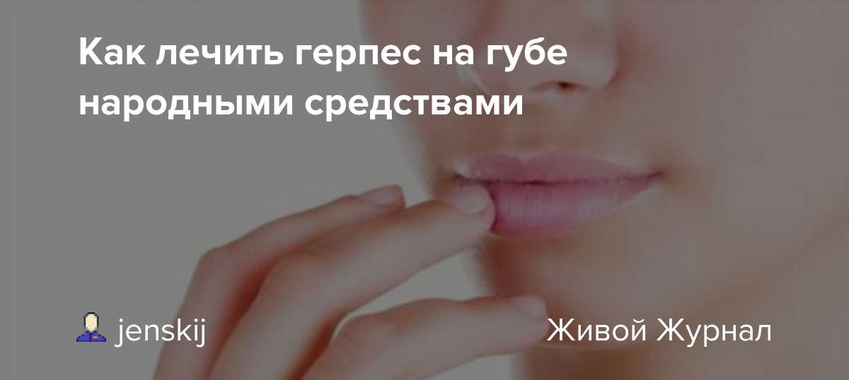 Герпес на губах лечение препараты быстро. Герпес на губах народные средства. Герпес на губах народные методы. Народные средства от герпеса на губах. Как быстро вылечить герпес на губах народными средствами.