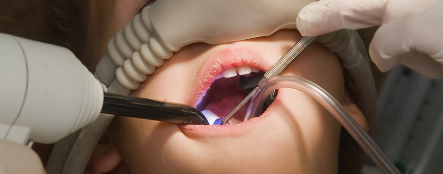 седация в детской стоматологии