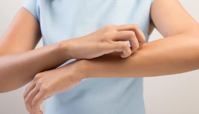 Почему возникает жжение кожи тела? Лечение проблемы в зависимости от причины