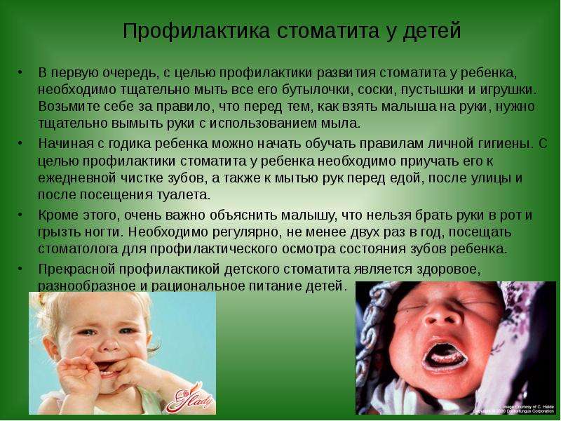 Стоматит Фото Ребенку 3 Года