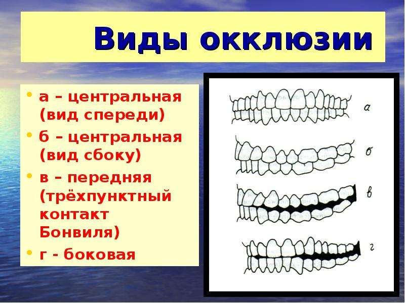 Признаки окклюзии. Артикуляция окклюзия прикус. Понятие окклюзии и артикуляции. Центральная окклюзия.