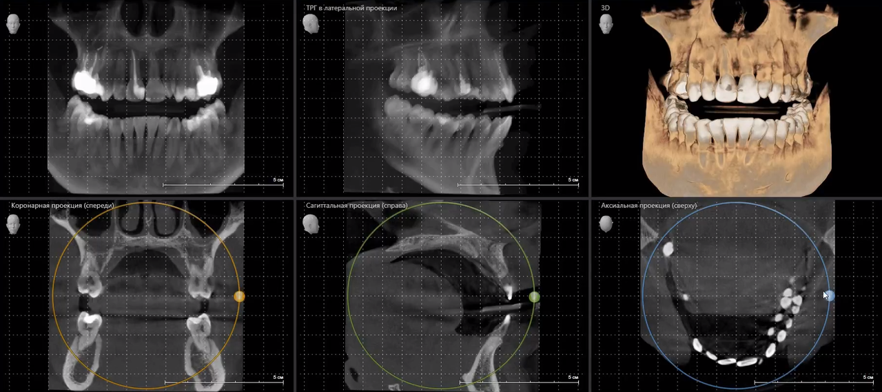 Делают ли мрт зуба. Кт 3d верхней и нижней челюсти.