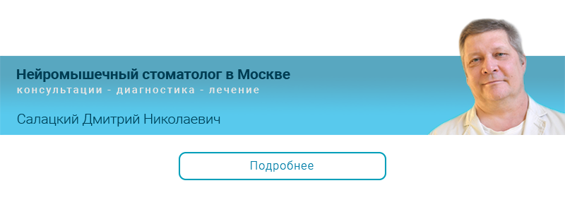 установка брекетов по акции