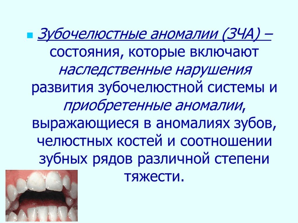 Зубной возраст. Зубочелюстных аномалий прикусы. Наследственные зубочелюстные аномалии зубов. Аномалии развития зубочелюстной системы. Зубной челюстгые анлмалии.