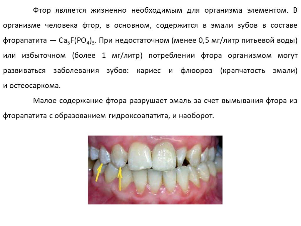 Влияние фторид иона на эмаль зубов проект 9 класс