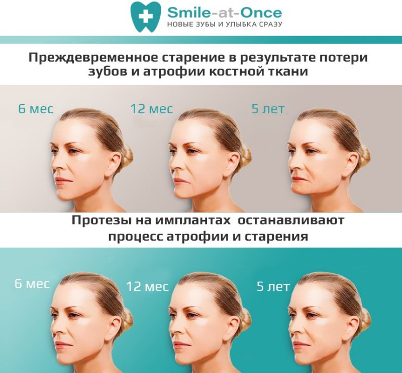 процесс старения
