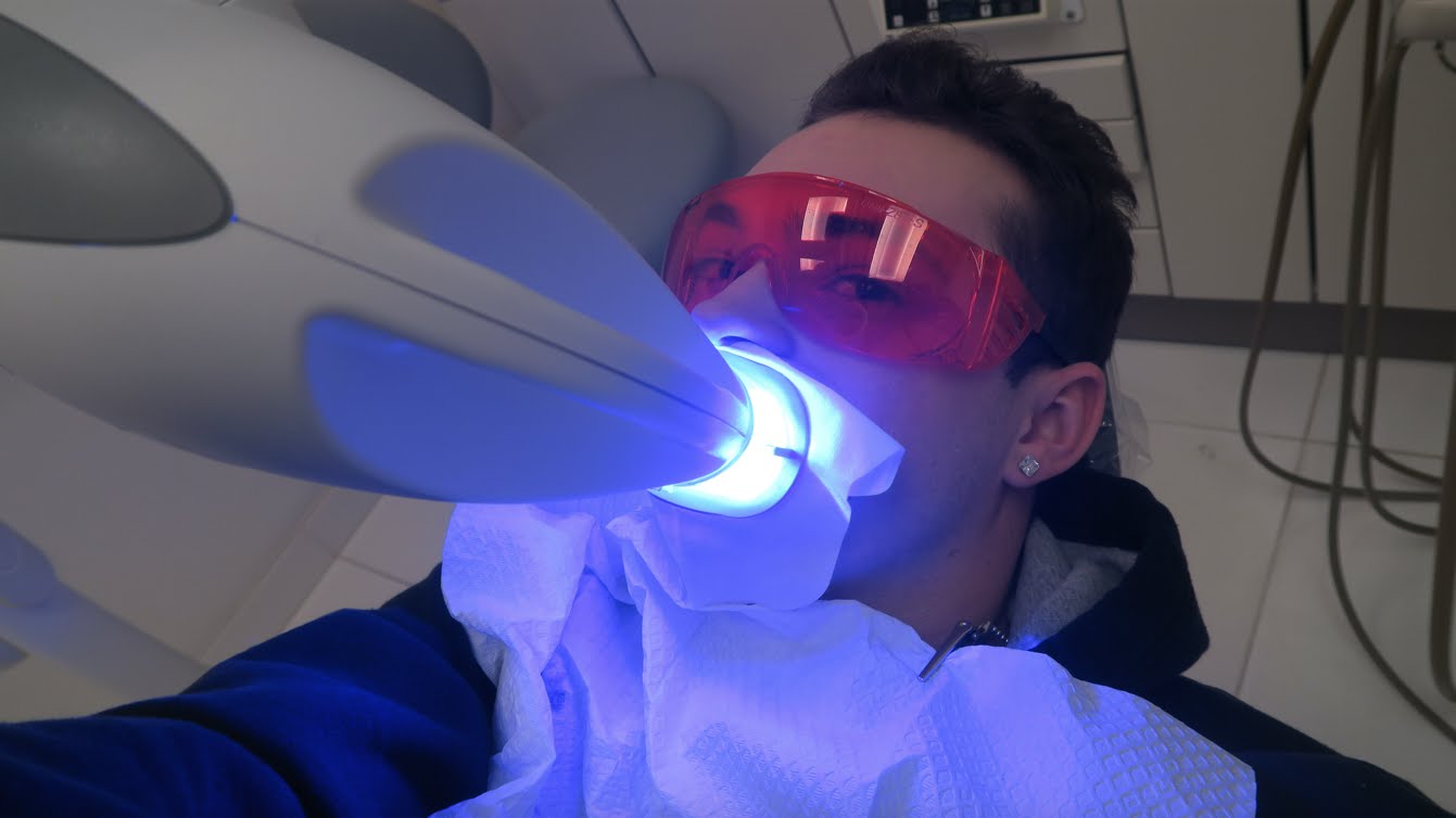 Лазерное отбеливание. Отбеливание лазером Zoom. Фотодинамическое био отбеливание. Laser Teeth Whitening.