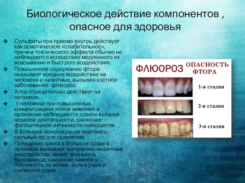 Длительный избыток фтора в организме может привести. Флюороз зубов (эндемический флюороз зубов) —. Причины возникновения флюороза.