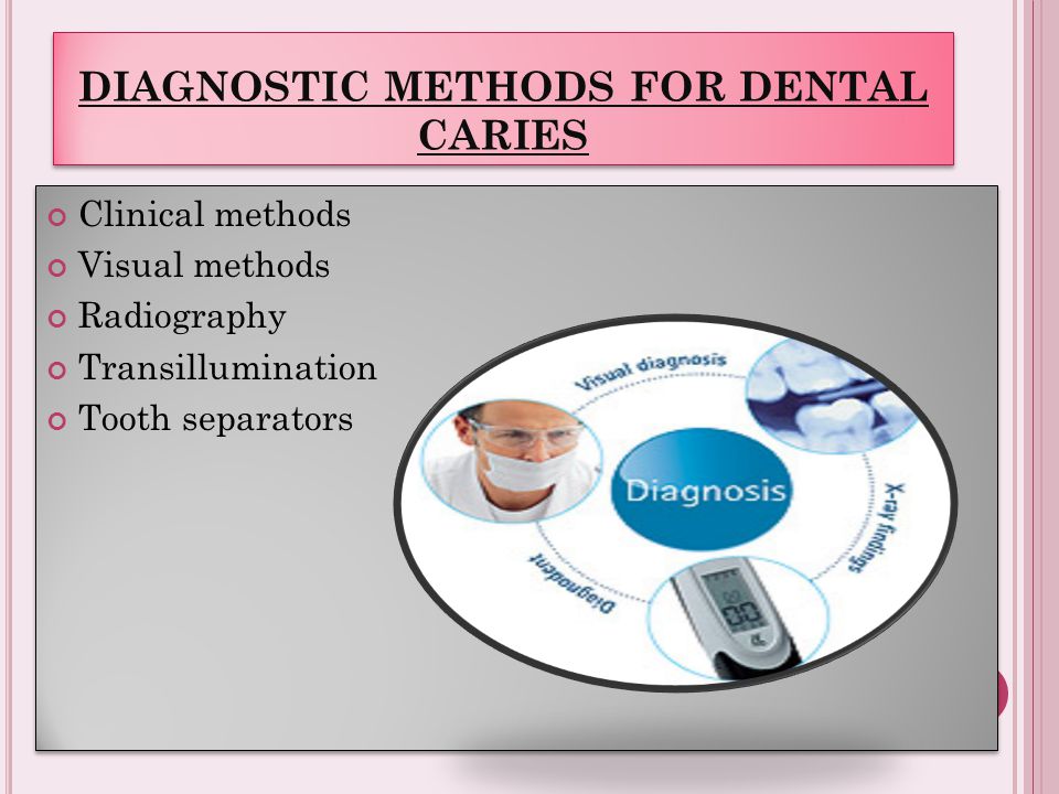 Diagnostic methods. Дополнительные методы диагностики кариеса медунивер. Visual method. Duodenostasis Diagnostic methods. Вутефд ч кфе вшфптщыешл.