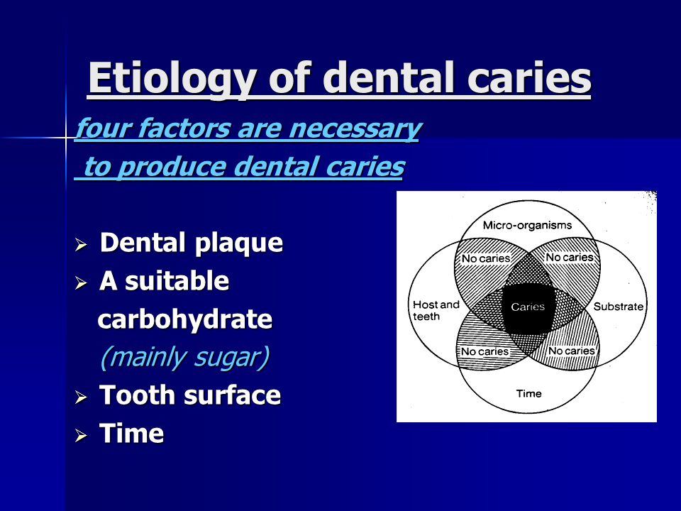 Etiology of dental caries