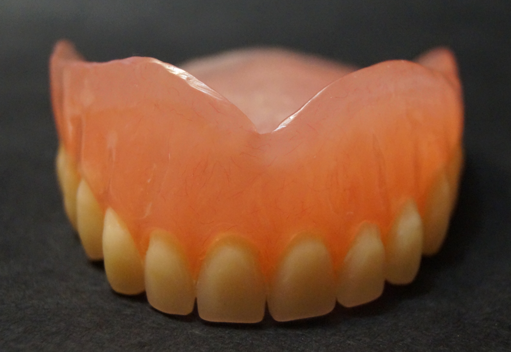 Нижний протез зубов какой. Полносъемный протез акрил. Съемный пластиночный протез на верхней челюсти. Иммедиат-протез полный съемный пластиночный протез. Съемный акриловый протез.