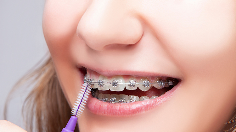 chistka-zubov-profilaktika.jpg
