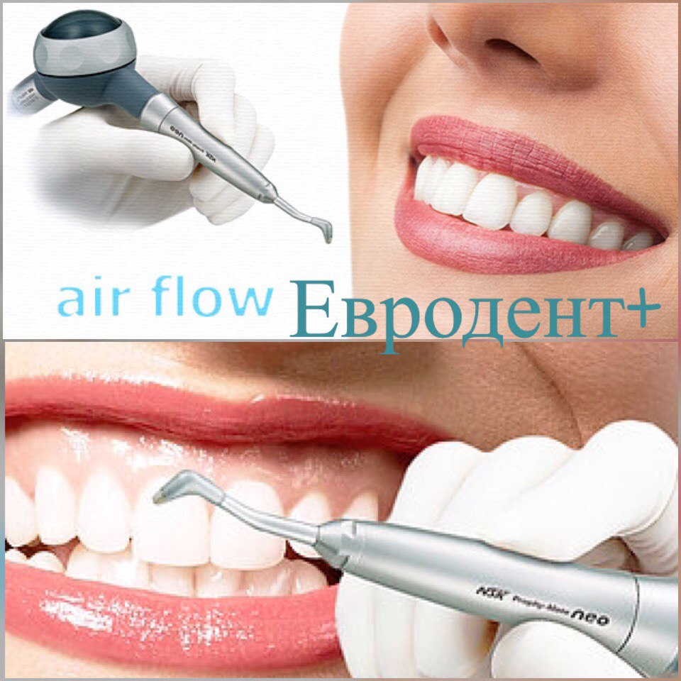 Airflow style pro. Ультразвуковая чистка Airflow зубов что это. Чистка зубов методом Air Flow.