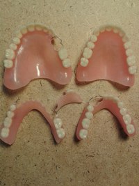 Протез на челюсть без зубов. Частичный съемный протез Flexi n512. Частичный съёмный протез Акрон. А23.07. 002.040 Полный съемный протез. Съемный протез (6-14 зубов) термо Джет.