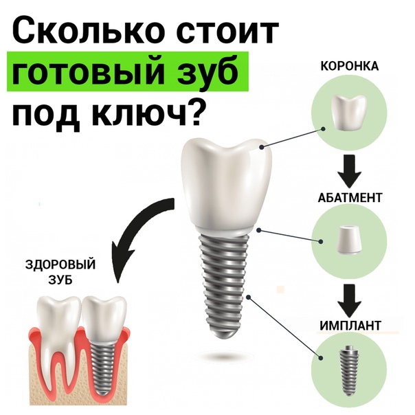 Импланты зубов недорого под ключ