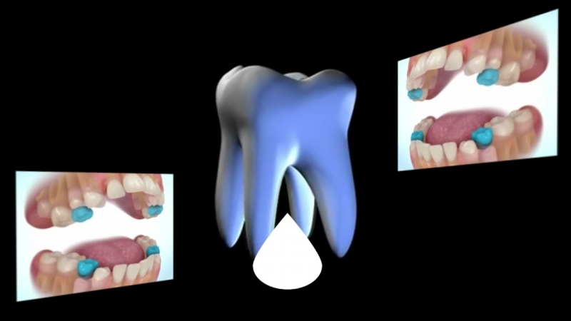Может ли вырасти новый зуб. Самовосстановление зубов. Регенерация зубов у человека. Регенерация новых зубов.
