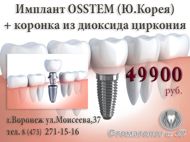 Имплант зуба пенза. Импланты Корея Osstem. Имплантация Osstem + циркониевая коронка.