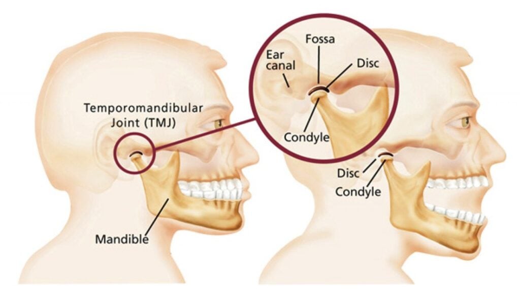 При открытии рта болит ухо. Болит челюсть возле уха. Болит челюсть возле уха и ухо. Боль в челюсти возле уха.