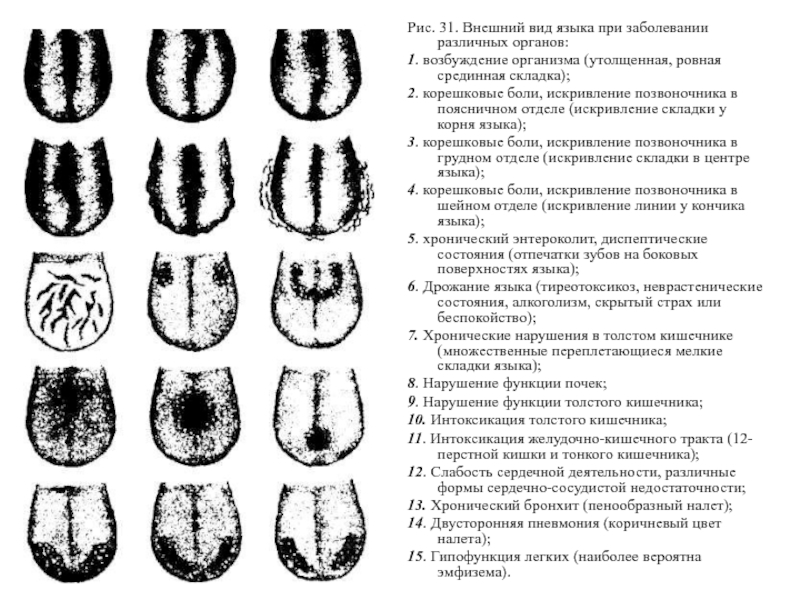 Язык человека определить болезнь