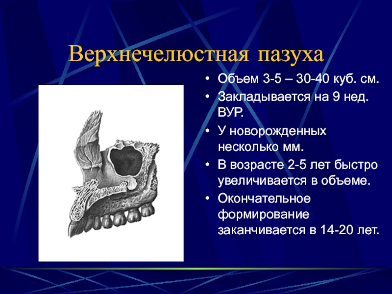 Верхнечелюстная пазуха картинка