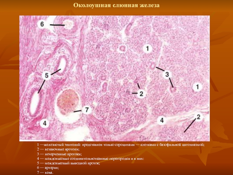 Желез 1. Междольковый проток околоушной железы эпителий. Междольковая соединительная ткань околоушной железы. Вставочный проток околоушной железы. Железистый эпителий в околоушной слюнной железы.