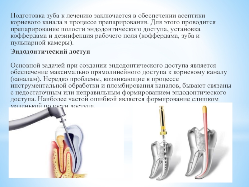 Определение корневых каналов. Шаги механической обработки корневых каналов. Этапы вскрытия полости зуба эндодонтия. Препарирование корневого канала.