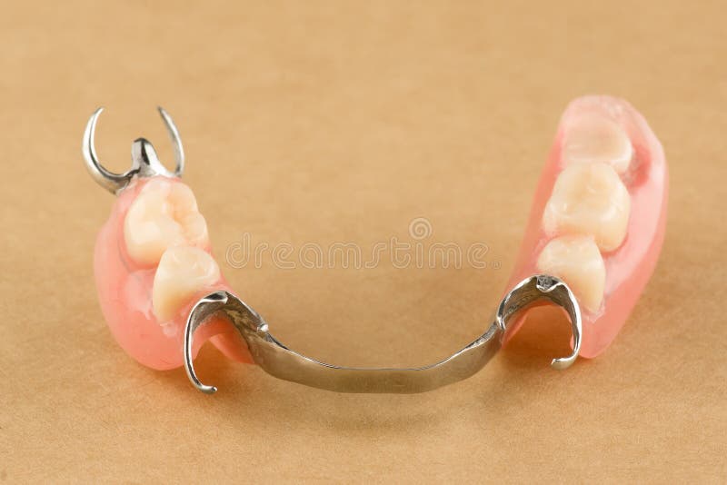 Arc dental prosthesis royalty free stock photography