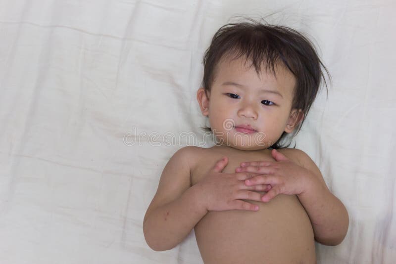 Asian baby infected. stock photo