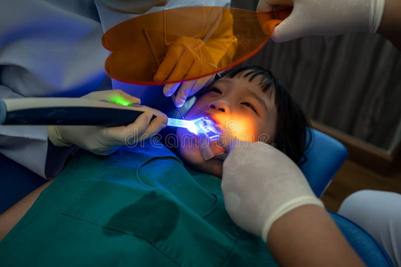 Asian girl getting dental filling treatment at molar tooth. With ultraviolet technology royalty free stock photo