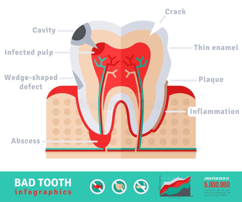 Bad tooth anatomy flat icon concept vector illustration