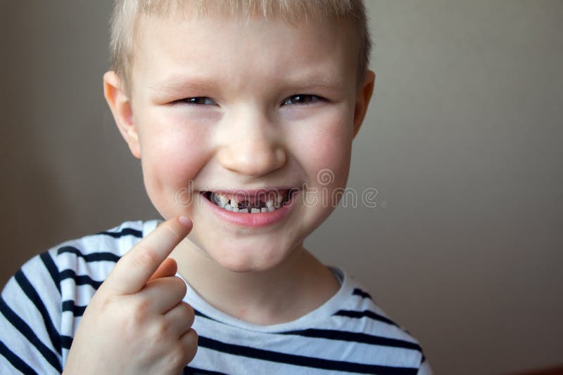 Boy missing milk teeth royalty free stock photos