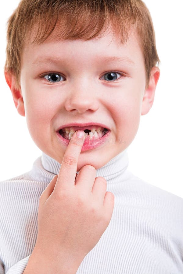 Boy showing his missing milk teeth stock images