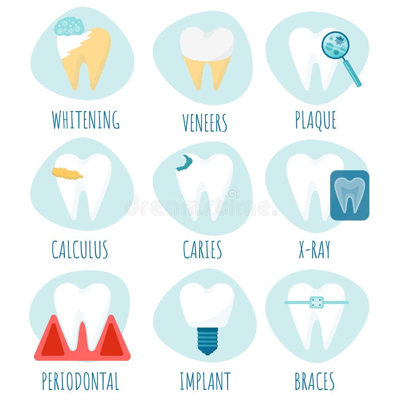 Various problems with teeth. Caries, tartar, plaque, periodontal disease. Dental implant and veneers. Cartoon vector set with teeth. Various problems with teeth royalty free illustration